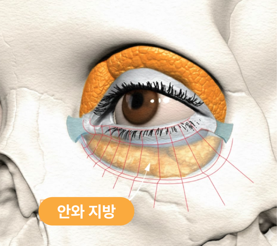 Understanding Gangnam Under-Eye Fat Repositioning, Causes of Hollow Under Eyes, and How the Structure Around the Eyes Changes with Age image 5