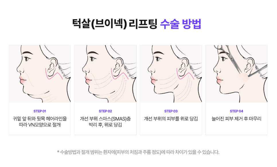 턱살리프팅, 강남역성형외과 여름다이어트 얼굴선 관리하는 법 관련 이미지 9