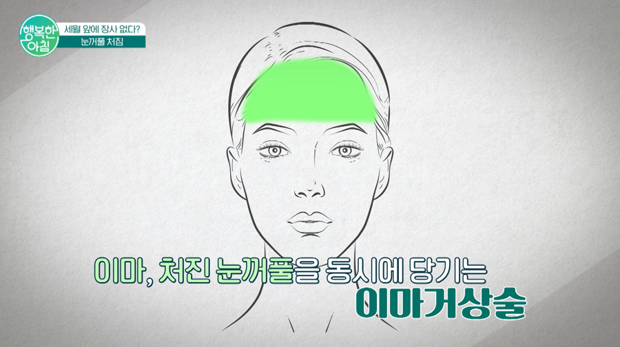 Forehead Lift for the Eyes and Overall Expression! Addressing Age-Related Changes All at Once image 3