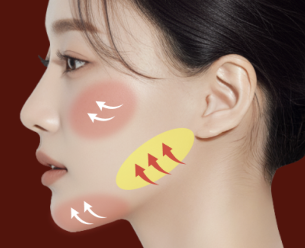 Sinsa Station Lifting Plastic Surgery Clinic Mini Contouring: How to Refine Facial Lines Without Bone Reduction | Liting Plastic Surgery Seoul Branch image 8
