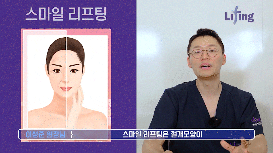 Smile Lifting Review and the Latest Lifting Trends Noted by Gangnam Lifting Dermatology Clinics image 7