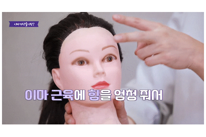 Songpa Plastic Surgery Forehead Wrinkle Botox: The Real Reason It Didn’t Work for Me image 2