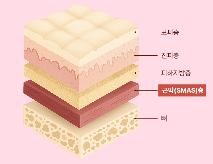 Facial Sagging Lift: Where to Start? Step-by-Step Elasticity Care Beginning with Apgujeong Thread Lifting image 3