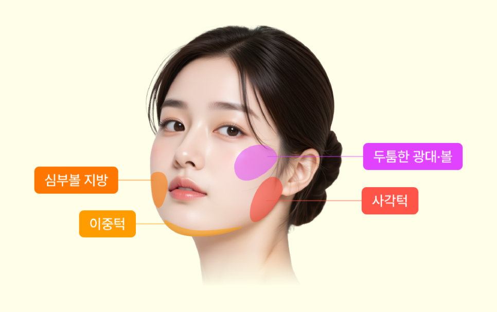 뼈 절제 없이 얼굴선 정돈, 안면윤곽수술의 또 다른 해석 | 리팅미니윤곽술 관련 이미지 12