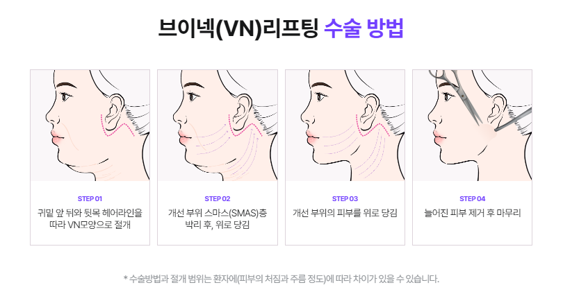 If you’re 고민ed about neck wrinkle procedures or neck wrinkle surgery, start with the wrinkle type at 리팅성형외과 image 7