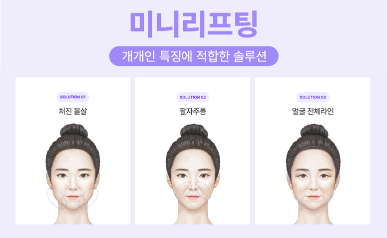 미니리프팅, 여름휴가 전 신사역성형외과에서 알아보는 인상 개선 방법 관련 이미지 6