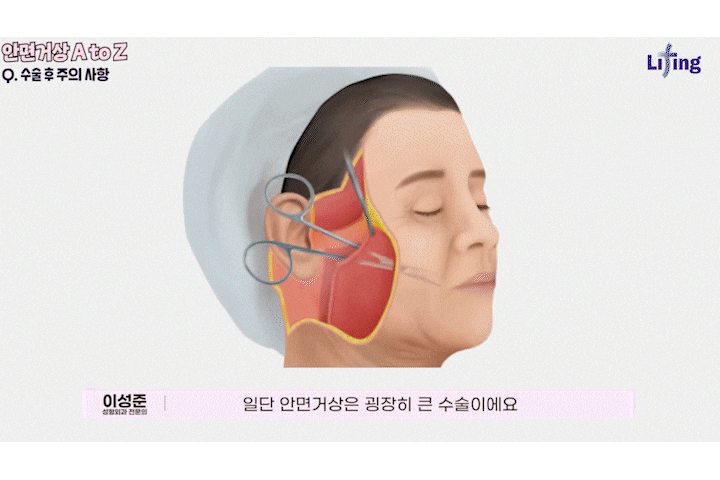 일산성형외과 안면거상후기 얼굴은 팽팽해졌는데, 왜 목주름이 더 눈에 띄는 걸까요? 관련 이미지 14