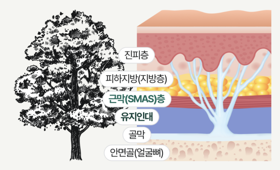 신사역안면거상 vs 미니리프팅, 결혼 앞뒀다면 꼭 체크해야하는 웨딩관리 포인트 (똑똑하게 결혼하기) 관련 이미지 14