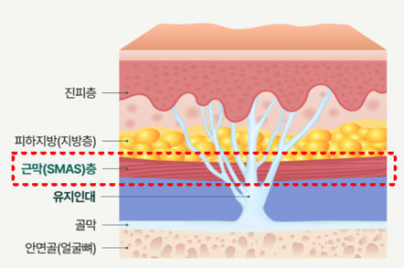 Is There a Natural Way to Look Younger by Getting Rid of Nasolabial Folds at Seoul Liting? image 7