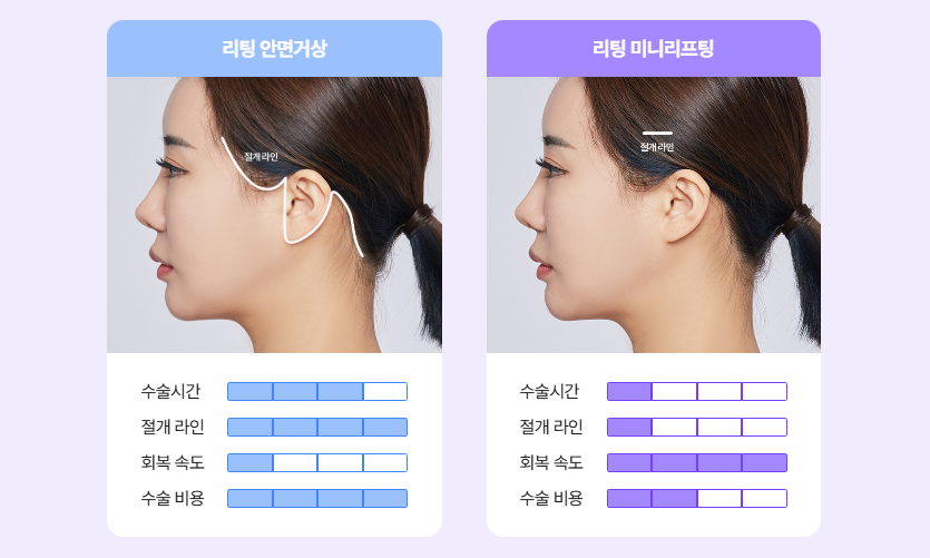 리팅성형외과 미니리프팅 궁금한 점 알려드립니다 관련 이미지 2