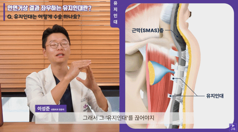 Double Chin Removal Surgery: Essential Things to Know Before the Procedure, Explained by a Specialist image 5