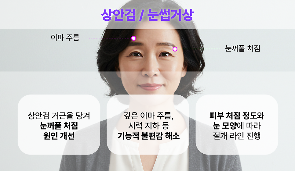 Mini Facelift, Gangnam Facelift: 3 Features That Create a Youthful Effect image 14