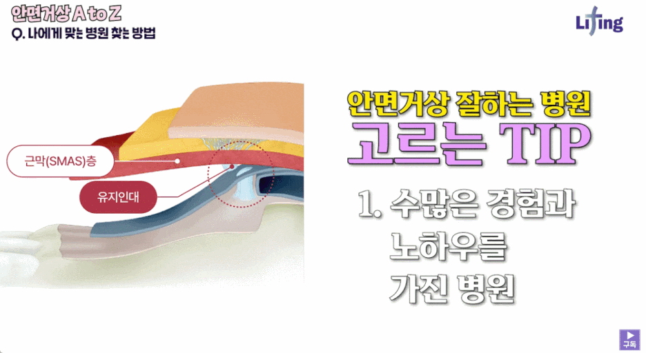 Learn the Criteria for Choosing Facelift Surgery in Gangnam image 7