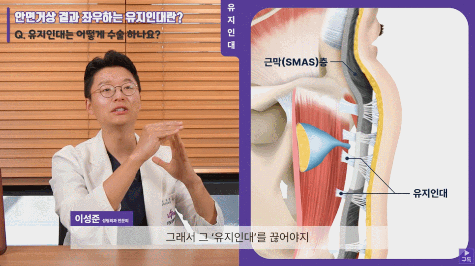 압구정안면거상은 관련 이미지 6