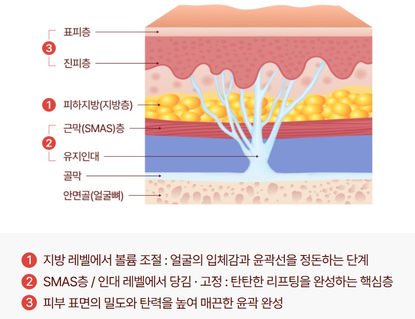 Sinsa Station Lifting Plastic Surgery Clinic Mini Contouring: How to Refine Facial Lines Without Bone Reduction | Liting Plastic Surgery Seoul Branch image 6