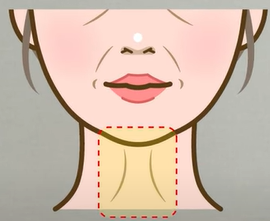 In Apgujeong plastic surgery, is revision lifting essential once the facelift maintenance period has passed? image 9