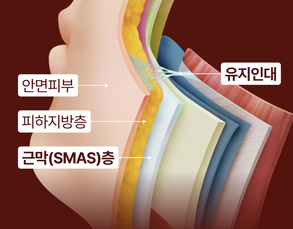 인중축소수술후기로 보는 얼굴 중심 비율의 재조정 ｜ 신사리프팅성형외과의 섬세한 접근 관련 이미지 10
