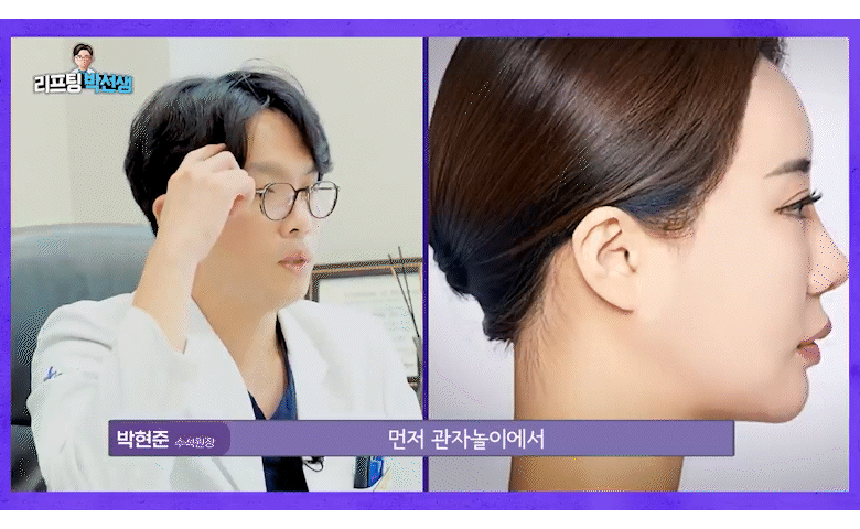 미니리프팅가격, 강남안면거상성형외과에서 보는 겨울 전 탄력 관리의 정밀 설계 관련 이미지 9