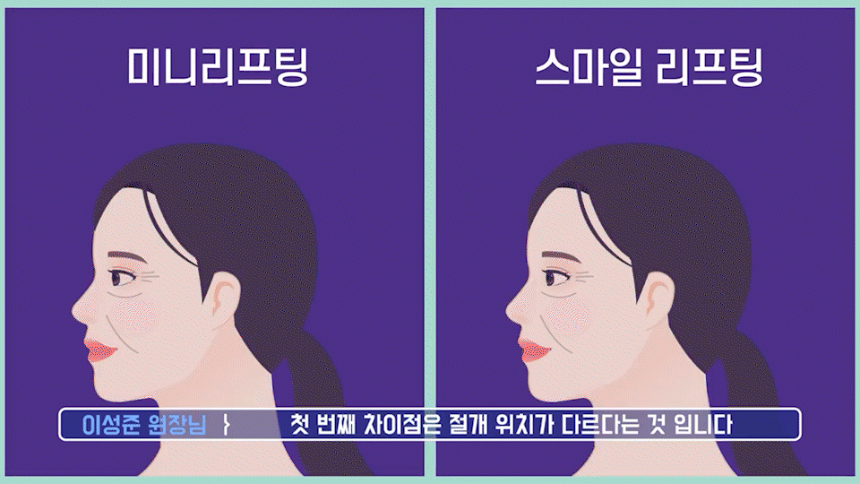 Gangnam Facelift vs. Sinsa Station Lifting: Why Is the Difference in Results So Big? image 11
