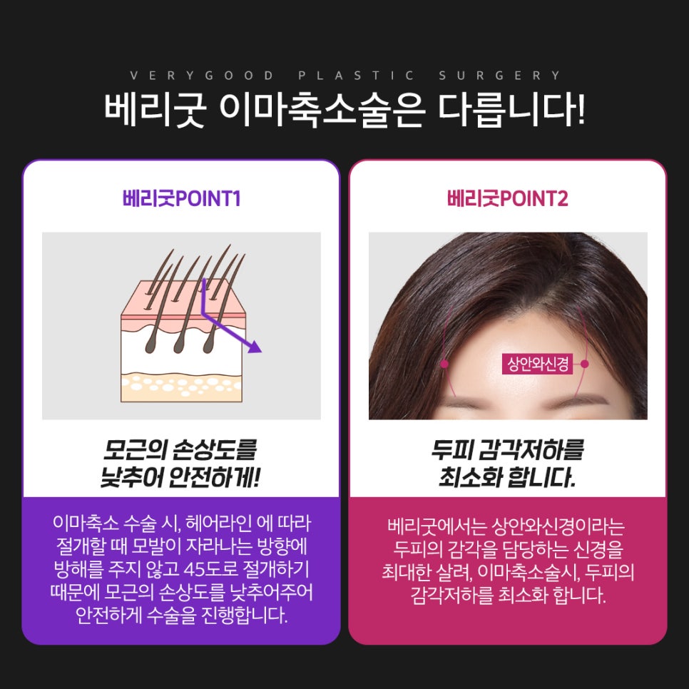 넓은 이마고민, 이마축소로 얼만큼 줄일 수 있을까?? 베리굿 이마축소후기로 확인하자! 관련 이미지 7