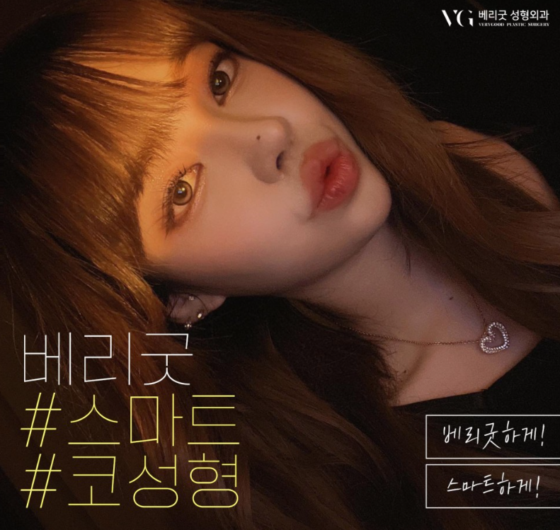 베리굿코성형 코성형후기, 강남성형외과 관련 이미지 1