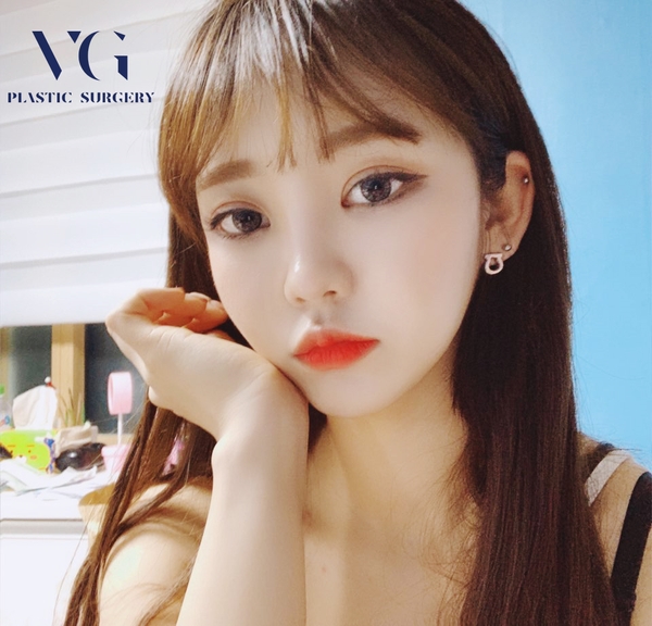 내시경 이마리프팅으로 주름개선과 또렷한 눈매를 한번에! 관련 이미지 1