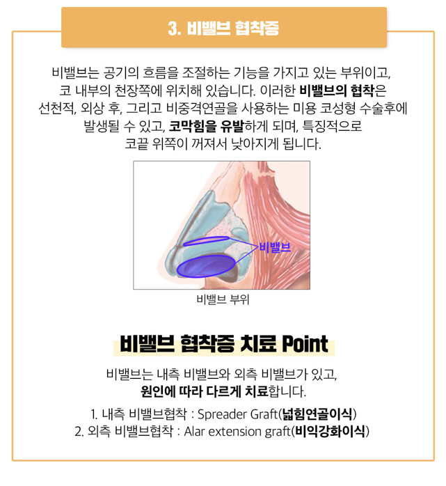 베리굿 비염코성형❤기능과 미용을 동시에?!😍 관련 이미지 7