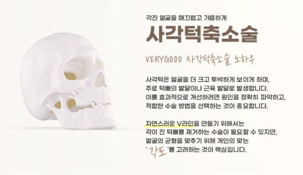 작고 조화로운 얼굴형을 꿈꾼다면, 베리굿성형외과 안면윤곽 관련 이미지 9