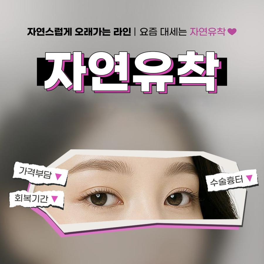 매몰은 걱정되고 절개는 부담될 때, 강남역 자연유착병원 첫 쌍수 추천 관련 이미지 2