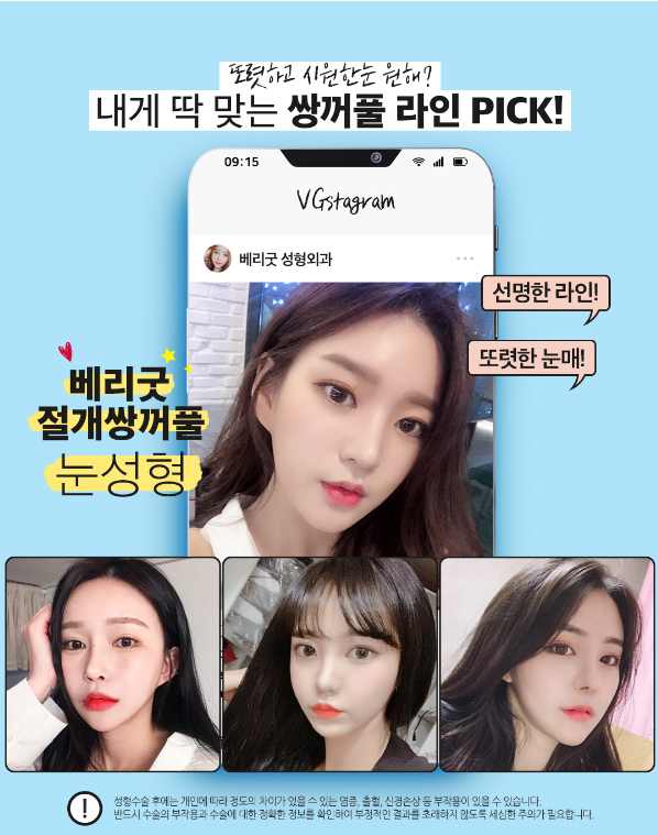 절개쌍꺼풀하고 모두의 시선을 사로잡는 또렷한 눈매 만들자! 관련 이미지 3