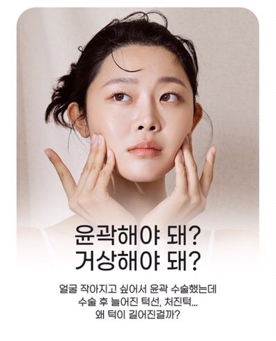 강남역 마녀턱 턱끝거상 , 리프팅원인 수술방법 총정리 관련 이미지 2