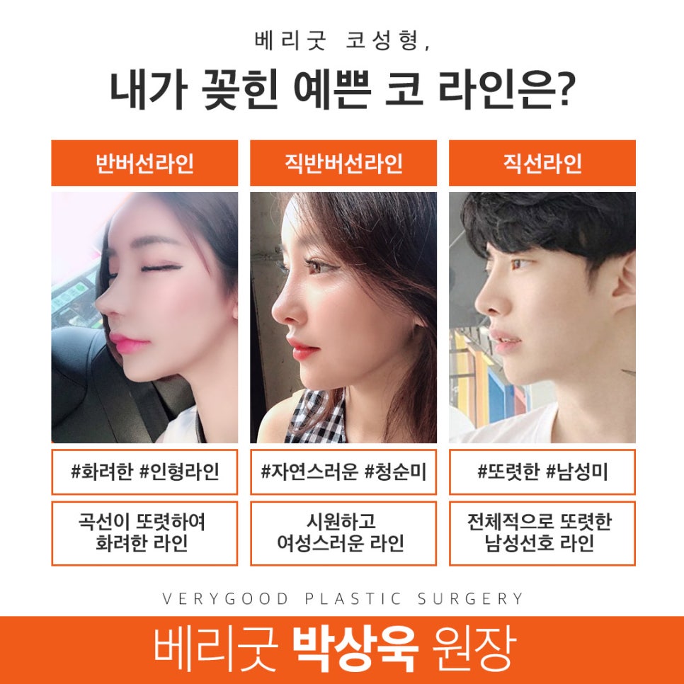 남자코성형 잘알아보고 확실하게 관련 이미지 6