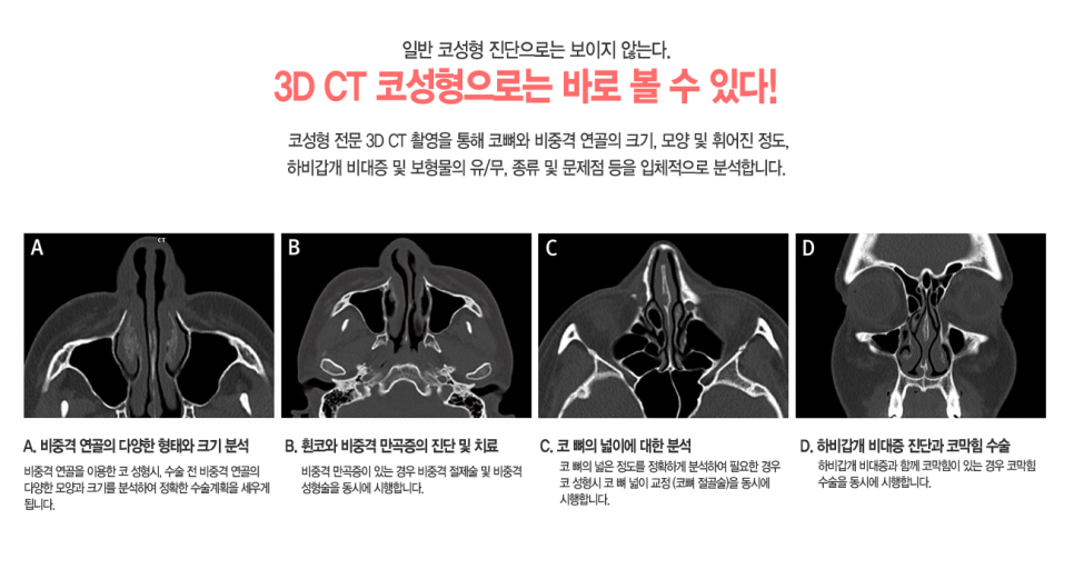 실패한 구축코재수술 베리굿에서 👨&zwj;⚕️✨ 관련 이미지 5