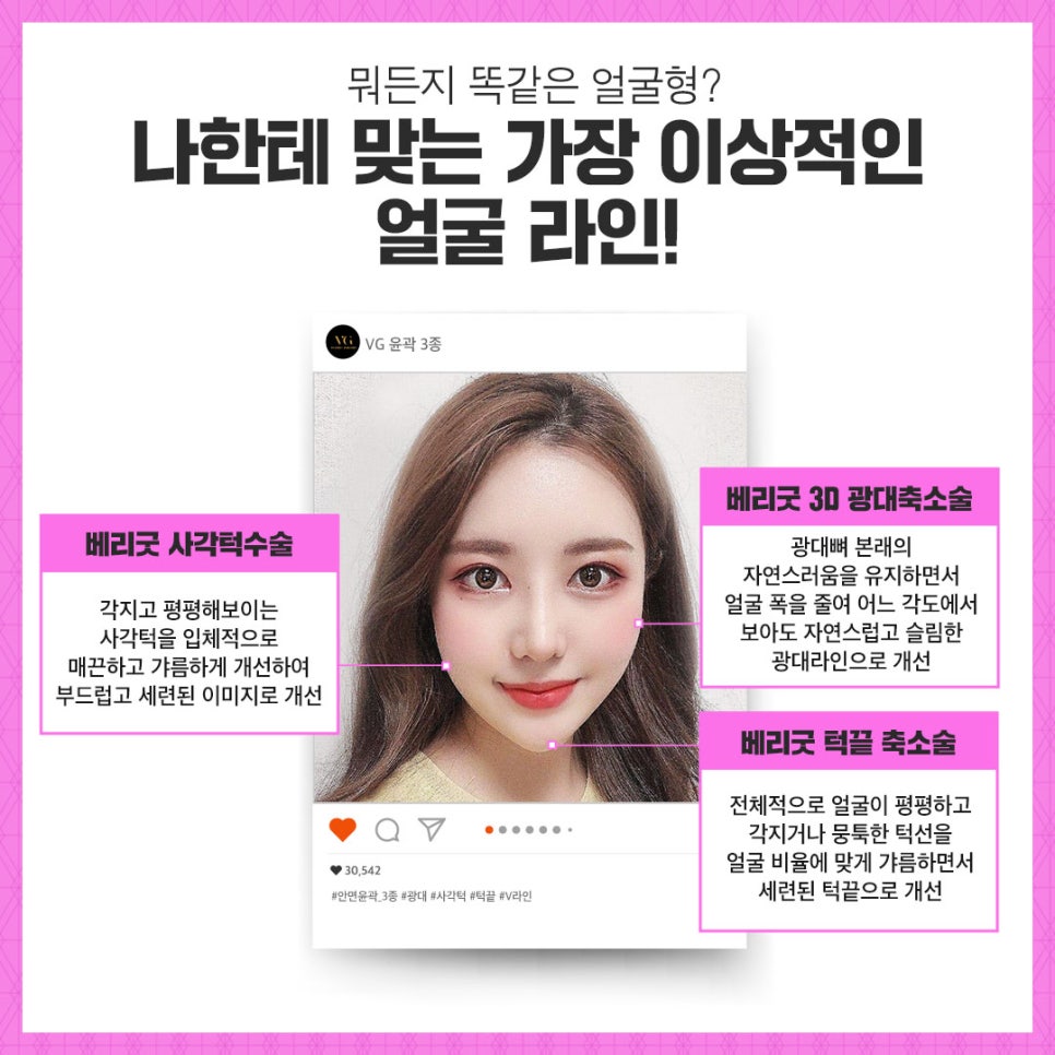 안면윤곽 잘하는곳 / 안면윤곽 가격 관련 이미지 3