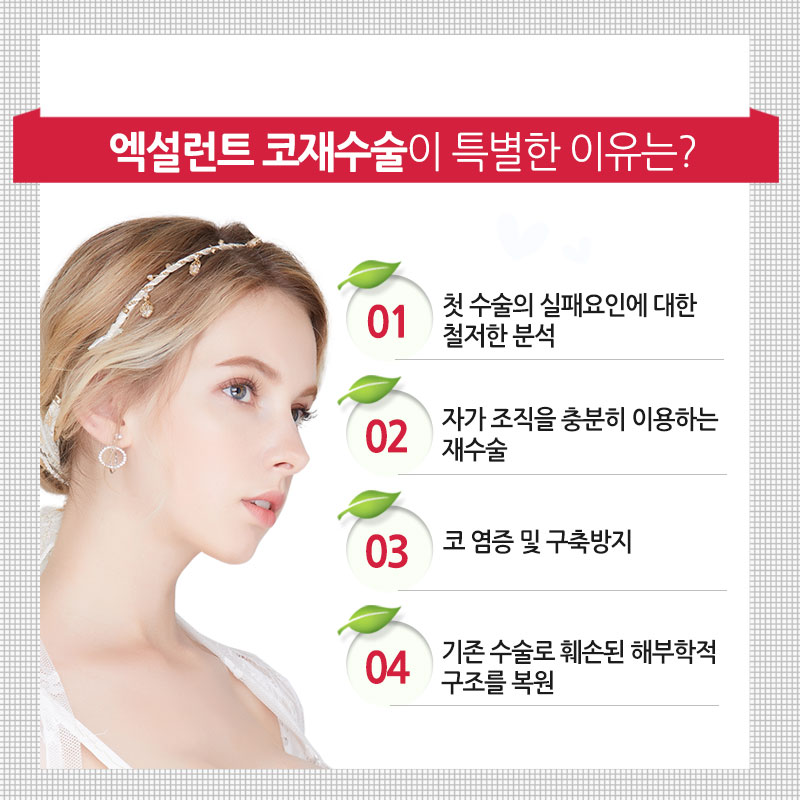 코재수술 베리굿성형외과! 엑설런트~! 임영민원장님 관련 이미지 3