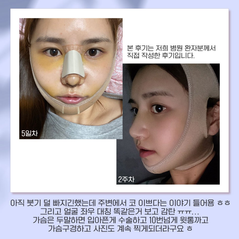 베리굿성형외과가 추천하는 성형별 추천👏 관련 이미지 14