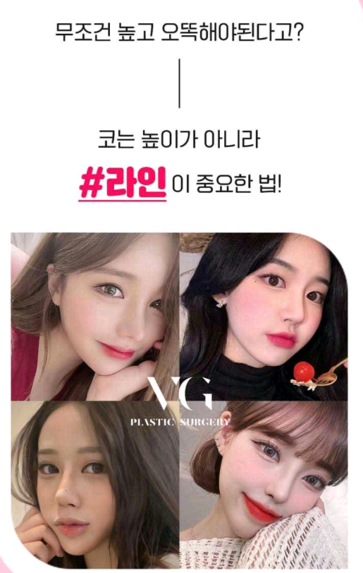 베리굿성형외과-MZ코,내돈 내산 코성형후기 mz세대의 유행하는 코성형은? 코성형부작용 1일차,3일차,1달차,전후후기 관련 이미지 2