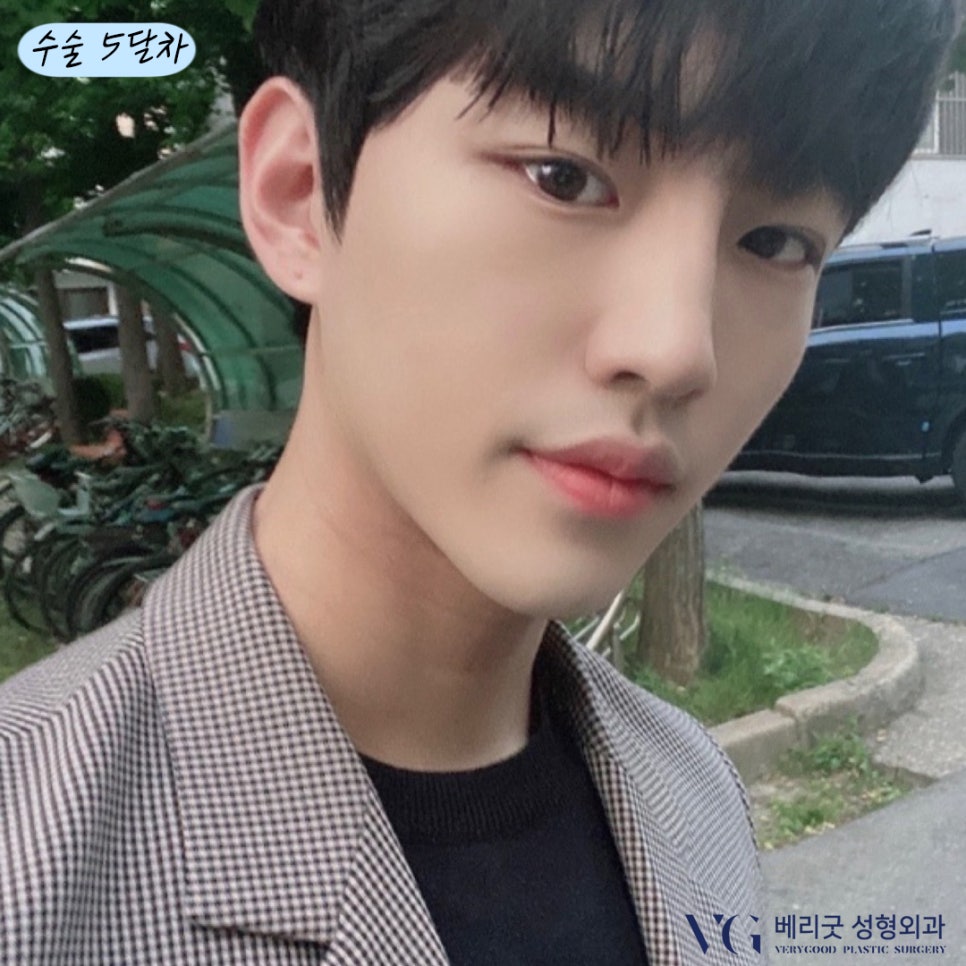 남자코 성형 다~ 모였다! 베리굿성형외과💙 관련 이미지 3