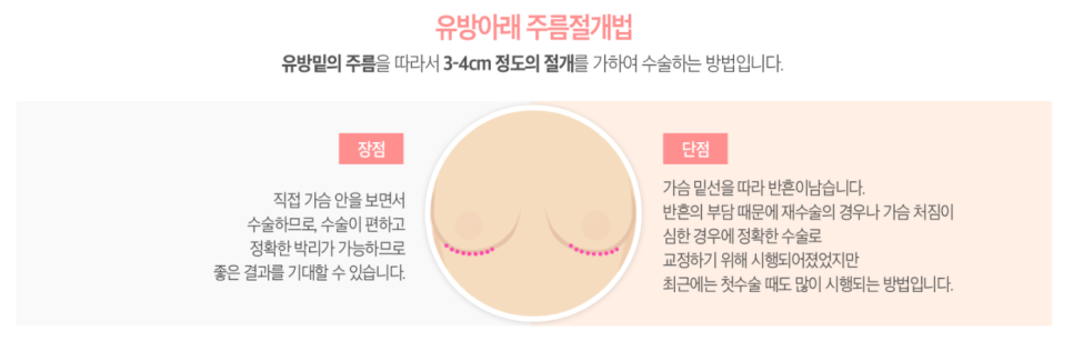 마른A컵도 가능🙈❤ 베리굿 성형외과의 베리굿 가슴성형✨ 관련 이미지 6