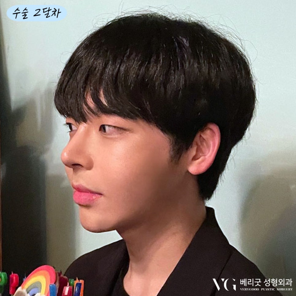 남자코 성형 다~ 모였다! 베리굿성형외과💙 관련 이미지 4