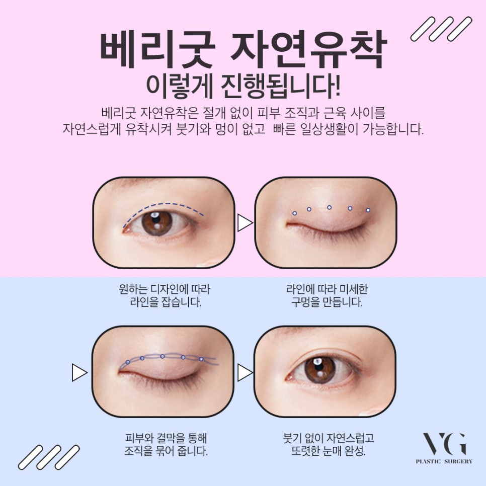 자연스러워! 베리굿 자연유착! 관련 이미지 4