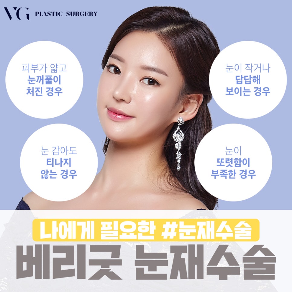 베리굿에서 눈재수술하고 이전보다 아름답게! 관련 이미지 4