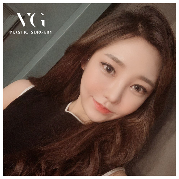 이마축소로 작고 아름다운 얼굴라인으로 변신! 관련 이미지 1