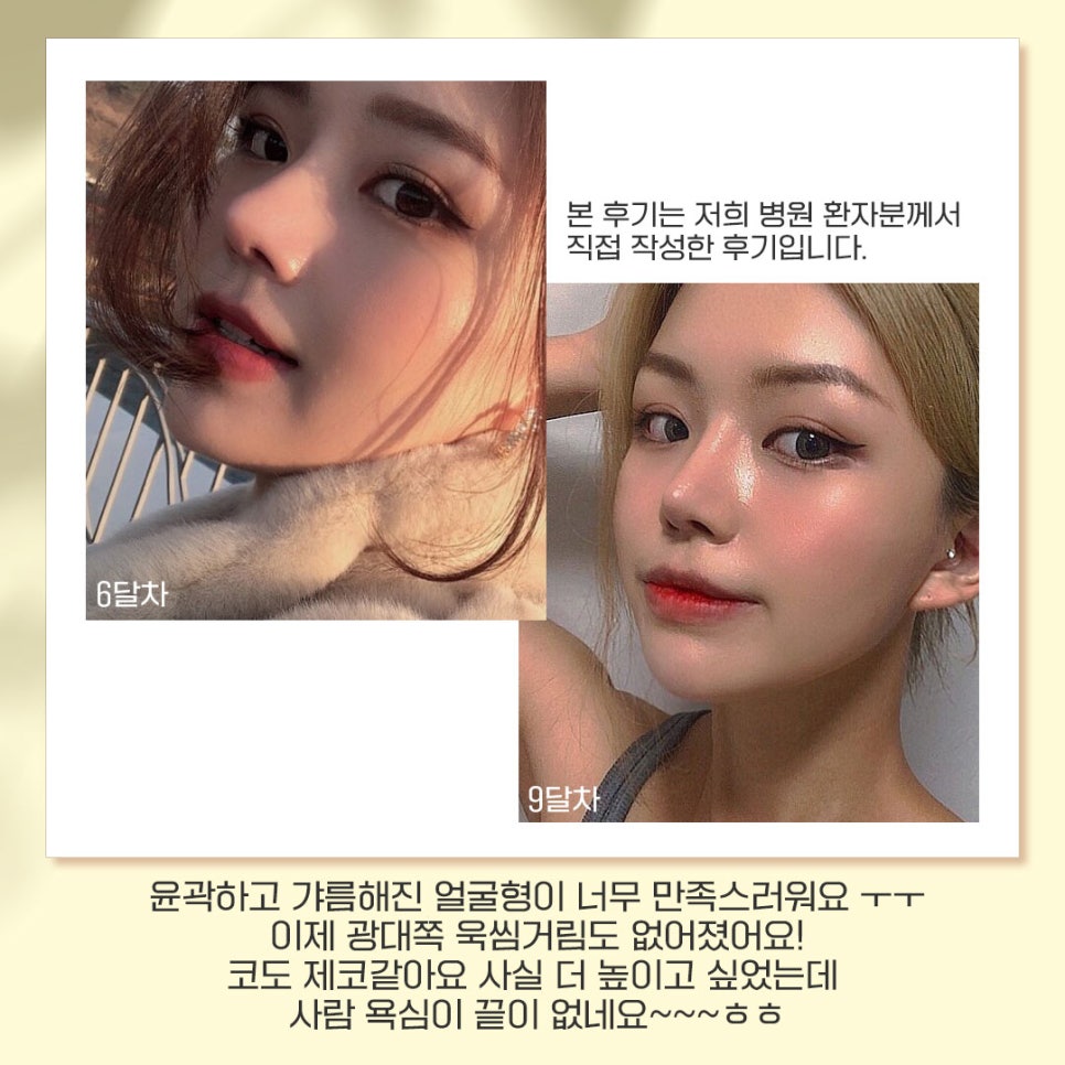베리굿성형외과가 추천하는 성형별 추천👏 관련 이미지 8