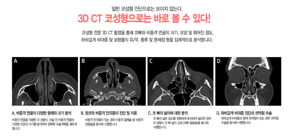 베리굿성형외과 어떤 코가 예뻐? 내 코가 제일 예뻐! 관련 이미지 5