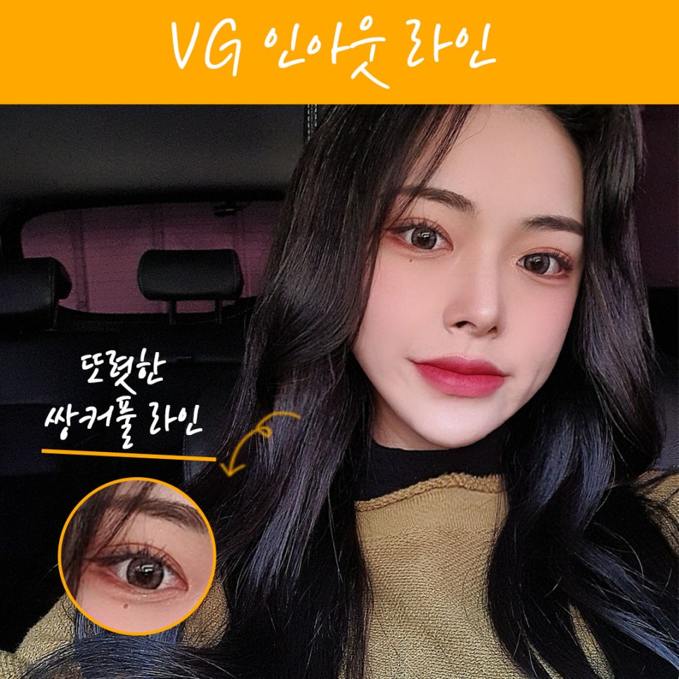 베리굿 성형외과 맞춤별 쌍수👀❤ 관련 이미지 4