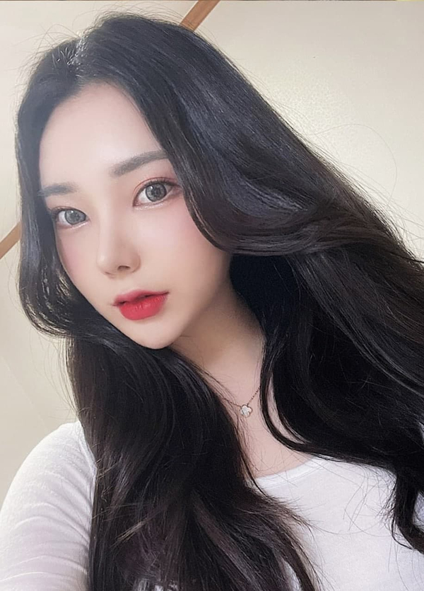 첫눈수술 절개?자연유착? 적합한 수술방법으로 관련 이미지 1