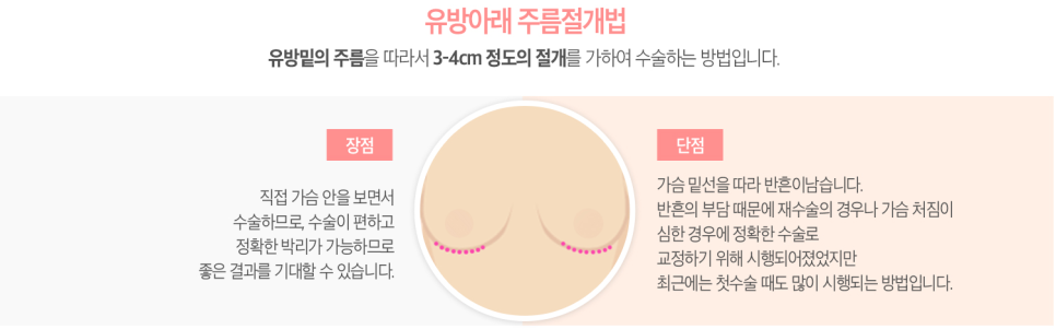 베리굿성형외과 보여줄게, 가진 자의 여유! 프리미엄 가슴확대술 관련 이미지 7