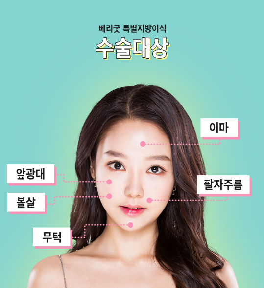 얼굴지방이식잘하는병원 매끄럽게 잘하는곳으로! 관련 이미지 4