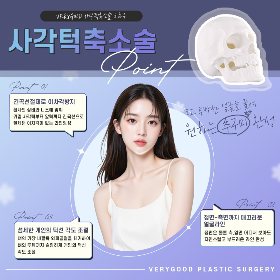 자연스러운 V라인 만드는 강남 사각턱축소술 , 3D-CT 분석으로 확인하는 윤곽 변화 관련 이미지 5